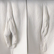 Detail showing a vulva pre and post labiaplasty.